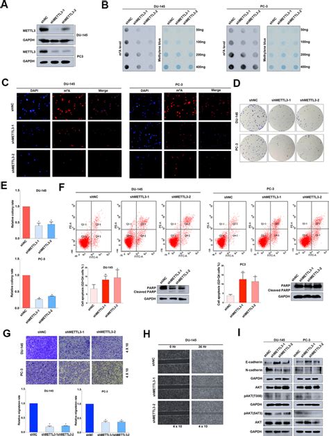 Knock Down Of Mettl Inhibits Pca Progression In Vitro A The