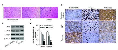 Decorin Overexpression Suppresses Gbm Invasion And Emt Phenotype A