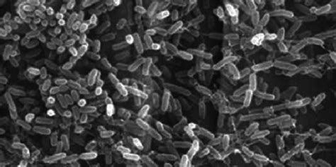 2 Electron micrograph of spoilage bacteria on a meat surface ...