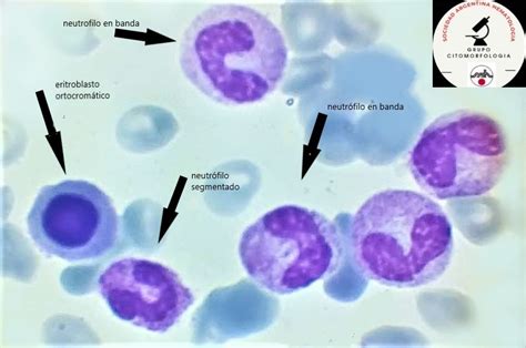 Sociedad Argentina De Hematolog A