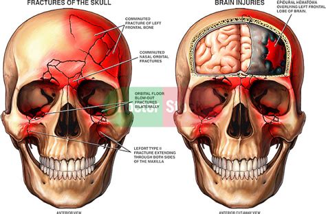 maskery blog