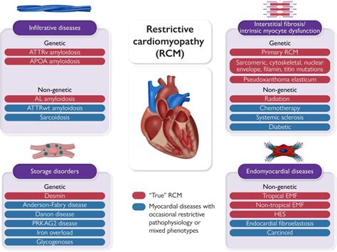 Restrictive Cardiomyopathy Definition And Diagnosis Pmc