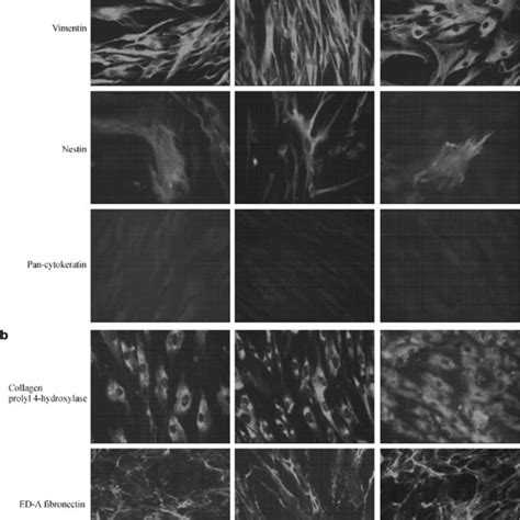 Expression Of Various Cytoskeletal And Extracellular Matrix Proteins In Download Scientific