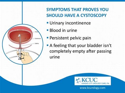 Cystoscopy - Detect and Treat Symptoms of Bladder Cancer