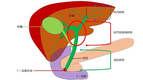 胆道がんの治療 国立がん研究センター 中央病院