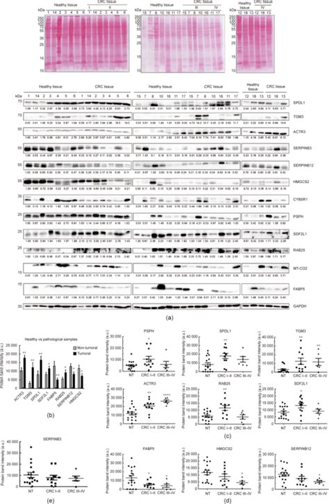 Western Blot 原理及基础应用详解剖析bcl蛋白质检测