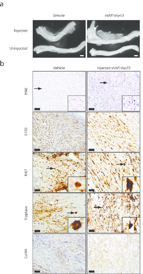 Mpnst Formation Is Accelerated In Nf1 Mice Harboring Embryonic Nf1 Download Scientific