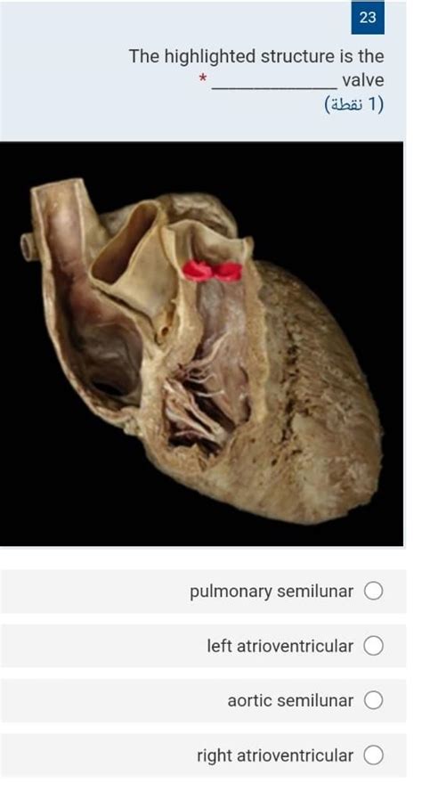 Solved 23 The highlighted structure is the valve (1 نقطة) 0 | Chegg.com
