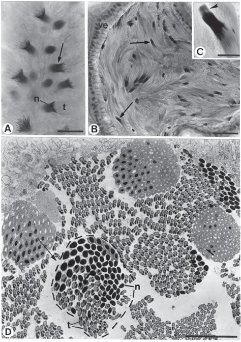 Light Micrographs A C And Transmission Electron Micrograph D Of