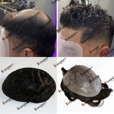 Pr Tese Do Cabelo Humano Para Homens Pele Dur Vel Poli Cabelo Injetado