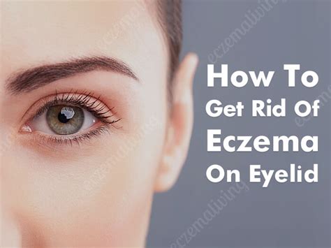 Eyelid Dermatitis - How to Get Rid of Eczema on Eyes?