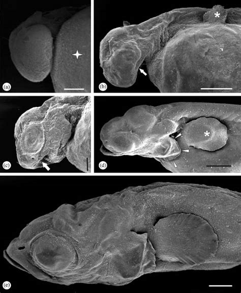 Scanning Electron Micrographs Showing Different Developmental Stages Of Download Scientific