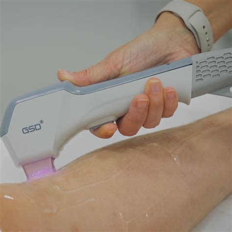 Epilação Feminina A Laser Diodo Perna Completa Sensispa