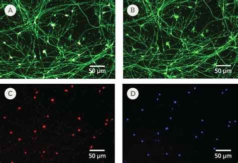 Stemdiff Forebrain Neuron Maturation Kit Stemcell Technologies