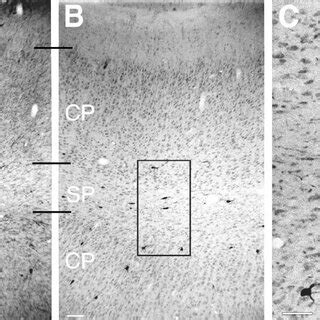 Time Course Of Ocular Dominance Column Formation In Ferret Visual