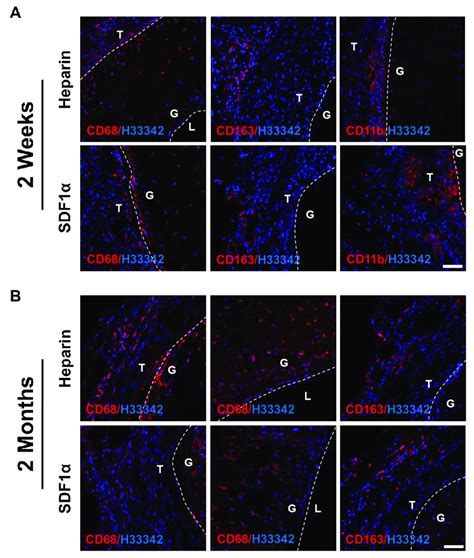 Inflammatory Responses Of Vascular Grafts Immunostaining For Cd68 Download Scientific Diagram