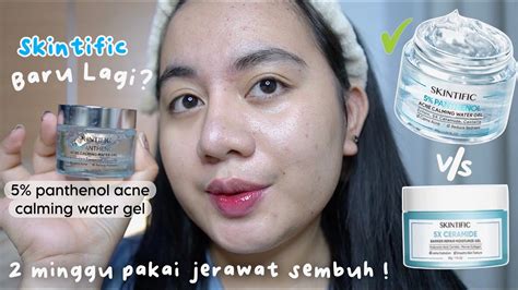 Review Jujur Moisturizer Skintific 5 Panthenol Di Kulit Kombinasi Dan