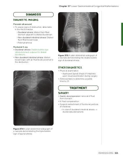 Intestinal Atresia Osmosis