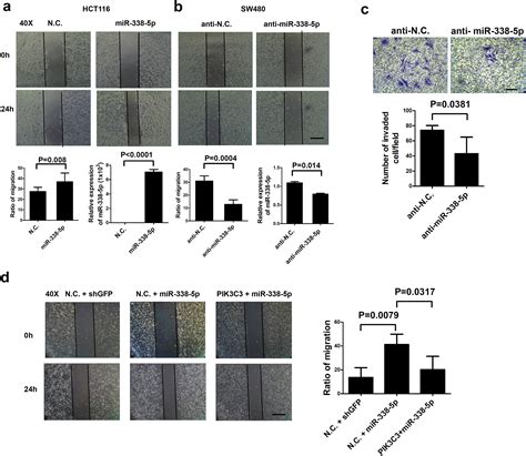 MiR 338 5p Promotes Metastasis Of Colorectal Cancer By Inhibition Of