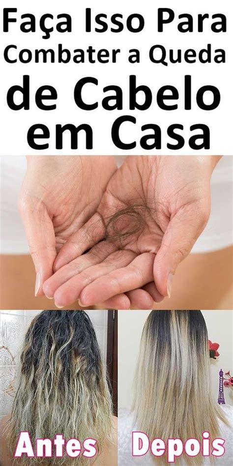 7 Maneiras Naturais De Evitar A Perda De Cabelo Perda De Cabelo