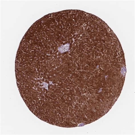 Tissue Expression Of Ldha Staining In Liver The Human Protein Atlas