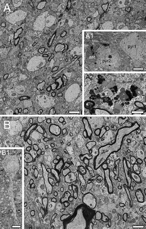 Neuronal Organization Of L In The Human Tln A Low Power Electron