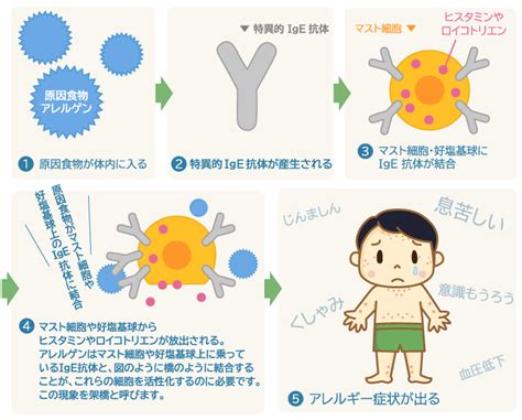 食物アレルギー発症のメカニズムと診断｜公益財団法人ニッポンハム食の未来財団