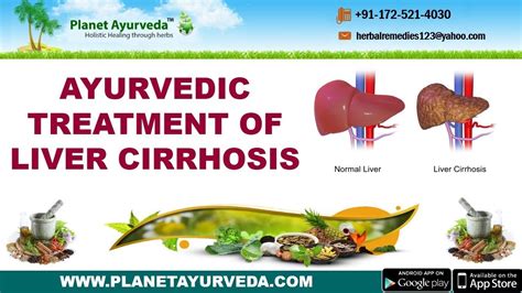 Ayurvedic Treatment Of Liver Cirrhosis Causes Symptoms Diagnosis