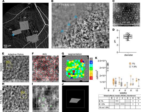 Jci Insight A Versatile Laser Induced Porcine Model Of Outer Retinal