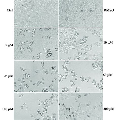 Representative Images Of Phase Contrast Of Control Hela Cells And Cells