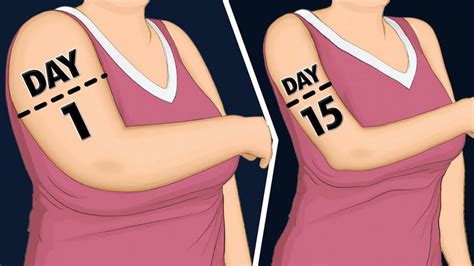 Two Images Of A Person With The Same Number On Their Arm And One Is