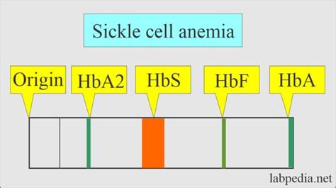 Hemoglobin:- Part 2 - Hemoglobin Electrophoresis, (Hb electrophoresis) - Labpedia.net