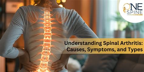 Understanding Spinal Arthritis Causes Symptoms Types