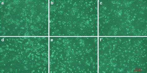 Effects Of Naf On The Morphology Of Primary Cortical Neurons A