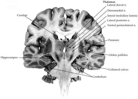 Neuroanatomical Correlates of Declarative Memory - Human Brain ...