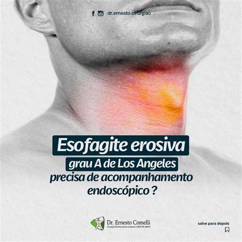 O Que Significa Esofagite Erosiva Grau A De Los Angeles