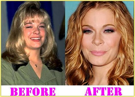 Leann Rimes Surgery Theroyalspeaker