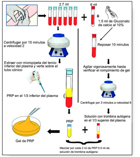 Esquema De Protocolo De Obtención Del Prp Velocidad 2 1235 Rpm Y Fcr Download Scientific