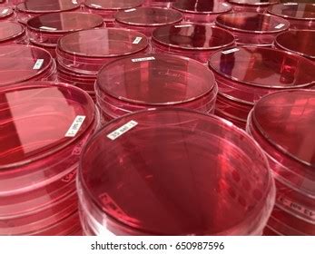 Stack Selective Agar Plate Culturing Bacteria Stock Photo