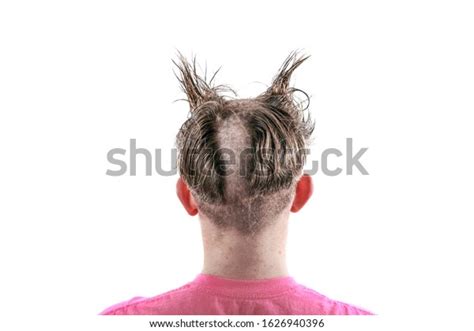 Ugly Hair Back View: Over 38 Royalty-Free Licensable Stock Photos ...