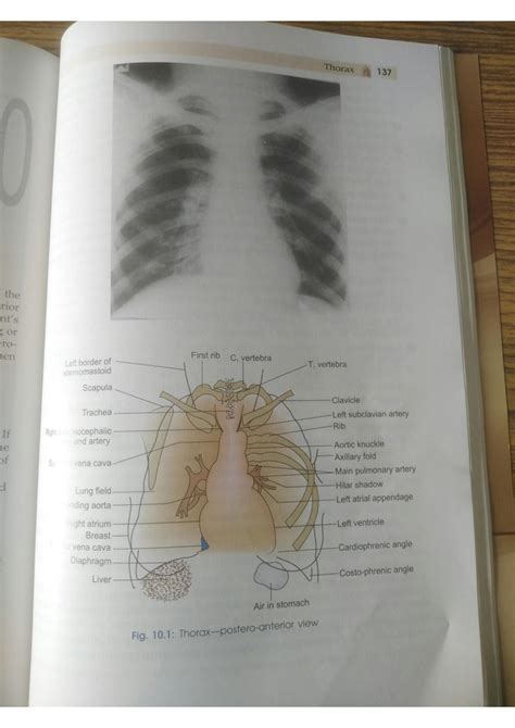 Solution Thorax Anatomy Studypool