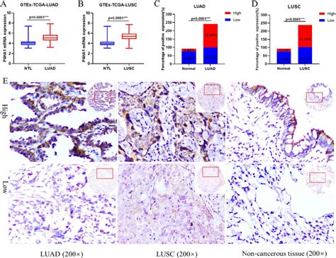 P Ha Is Upregulated In Lung Cancer A B P Ha Mrna Expression In