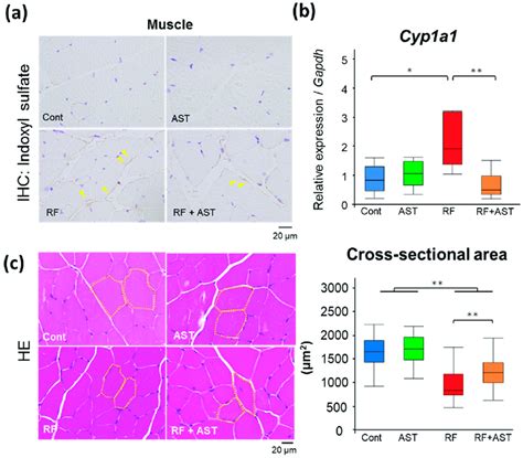 Renal Failure Induced Skeletal Muscle Atrophy Was Ameliorated By