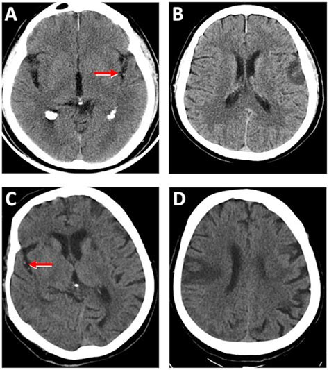 PubMed Central RMMJ Rambam Maimonides Medical Journal Rambam Health