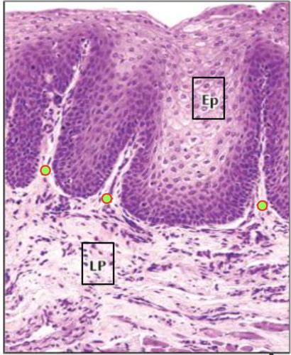 Histology Diagrams Oral Mucosa Flashcards Quizlet Sexiz Pix