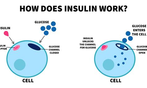 Short Acting Insulin What Is It