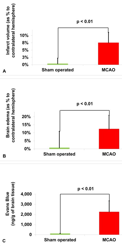 Video: Measuring Post-Stroke Cerebral Edema, Infarct Zone and Blood
