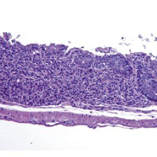 Fty Reduces Gvhd Associated Tissue Infiltration Large Bowel Tissues