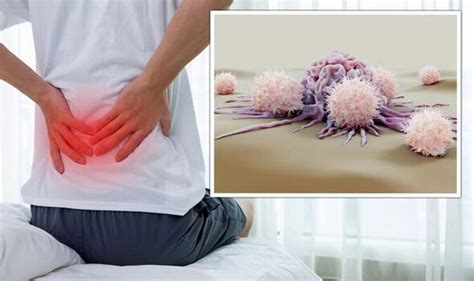 Cancer symptoms can include back pain – visit your doctor | Express.co.uk