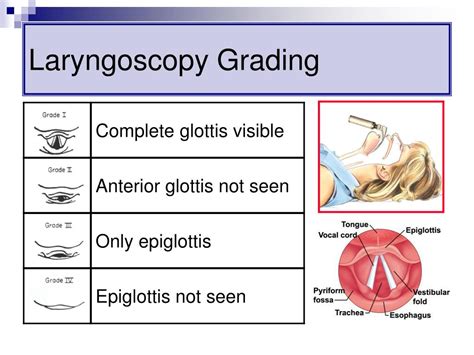 Ppt Airway Management In The Critically Ill Powerpoint Presentation